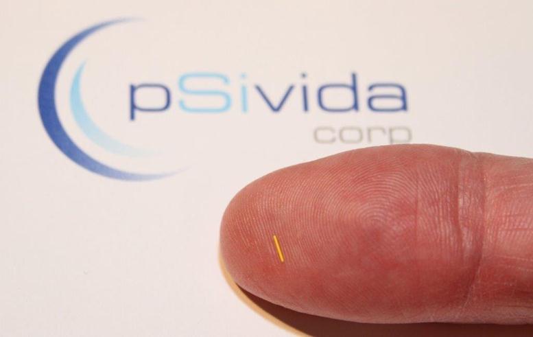 Earnings of -$0.15 Per Share Expected from pSivida C...